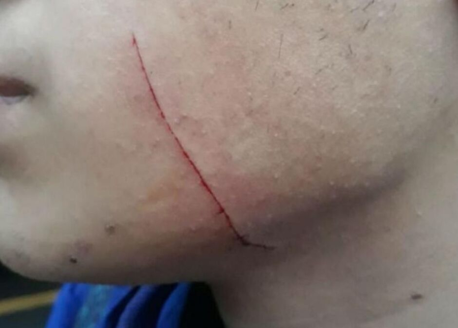 Briga entre vizinhas termina em agressão e mulher ferida em Três Lagoas